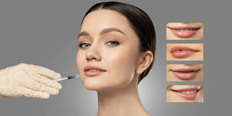 Lip Fillers